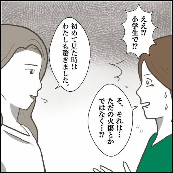 ＜小学生トラブル＞「腕に根性焼きの痕が…」トラブルメーカーの姉弟！？小6で自ら体を傷つける姉