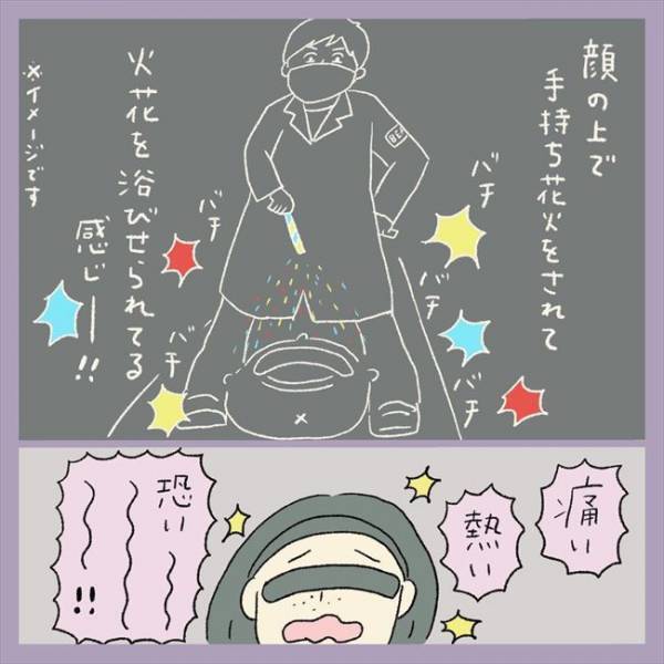 ＜アラフォーシミ取り＞「痛い！熱い！」顔面麻酔で無双状態…のはずが、レーザーをあてると？！