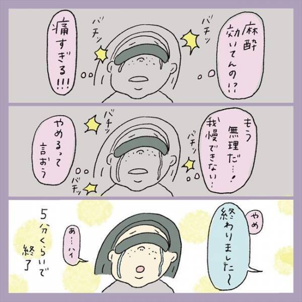 ＜アラフォーシミ取り＞「痛い！熱い！」顔面麻酔で無双状態…のはずが、レーザーをあてると？！