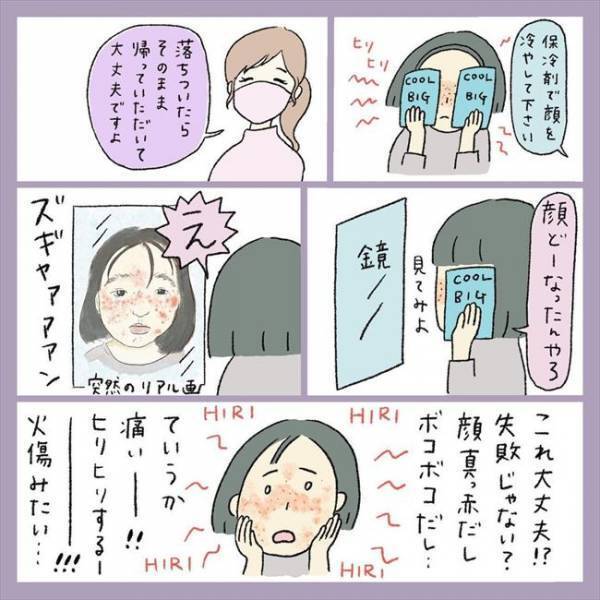 ＜アラフォーシミ取り＞「痛い！熱い！」顔面麻酔で無双状態…のはずが、レーザーをあてると？！