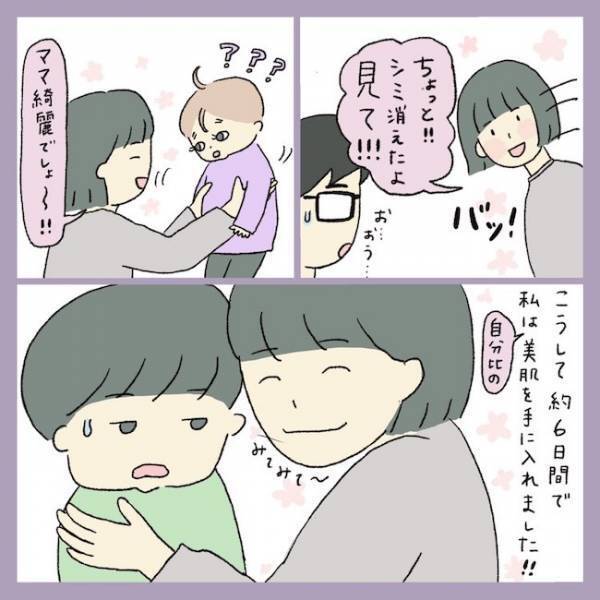 ＜アラフォーシミ取り＞「うわ！エグッ」術後の赤みとヒリヒリに不安。ダウンタイムの経過は？！