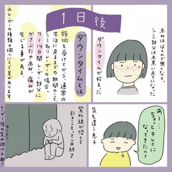 ＜アラフォーシミ取り＞「うわ！エグッ」術後の赤みとヒリヒリに不安。ダウンタイムの経過は？！