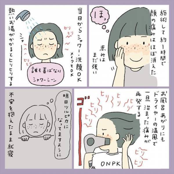 ＜アラフォーシミ取り＞「うわ！エグッ」術後の赤みとヒリヒリに不安。ダウンタイムの経過は？！
