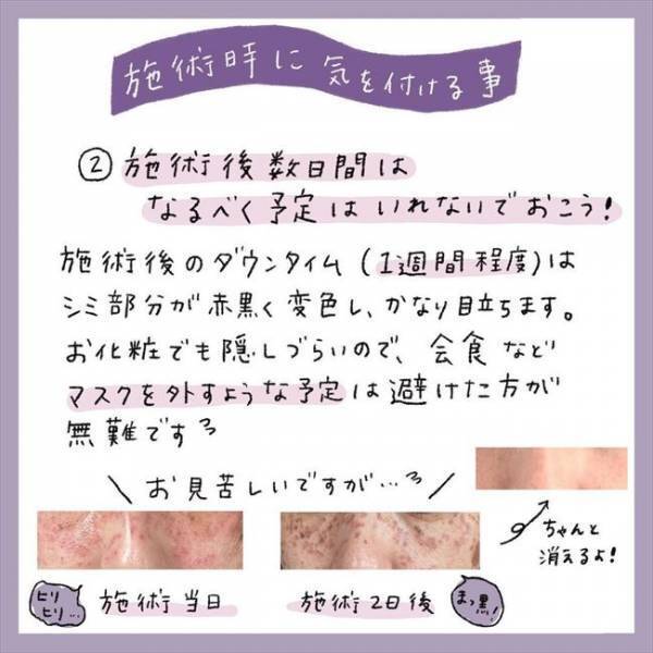 ＜アラフォーシミ取り＞「毎日ご機嫌♪」結局コスパよし？！やってわかったシミ取りのメリット