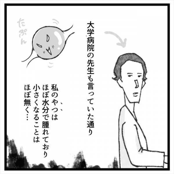 「私、卵巣嚢腫やねん」カミングアウトすると友人たちの反応は！？＜手術から逃げ続けた話＞
