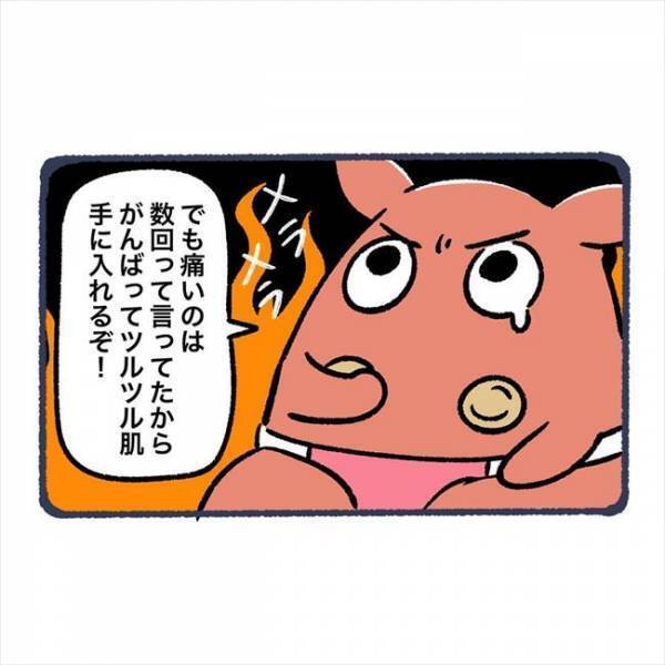 ＜脱毛でビクンビクン＞「くぁっ」下着の隙間に機器を差し込まれ…冷や汗が止まらない！