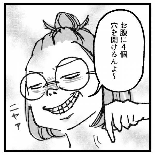 「おなかに穴を開けるんよ」ママが手術することを告げると娘たちの反応は？