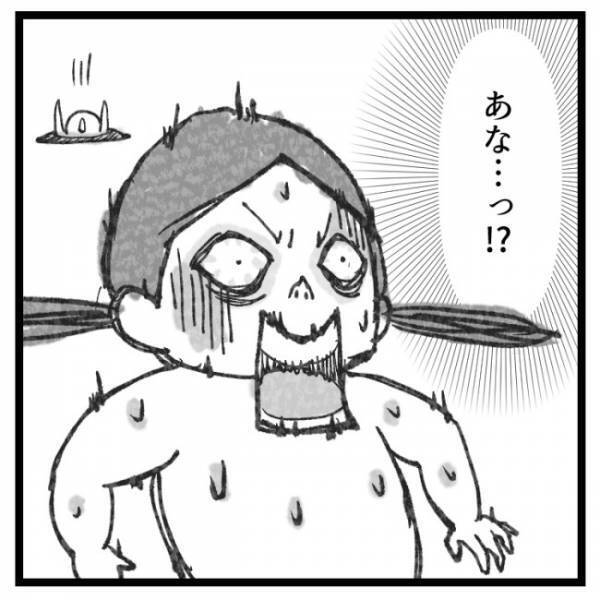 「おなかに穴を開けるんよ」ママが手術することを告げると娘たちの反応は？