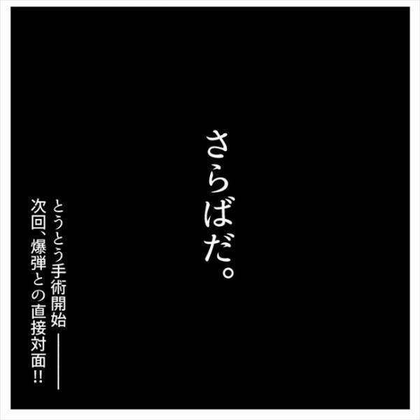 ＜おなかの爆弾とりました＞「爆弾よ…さらばだ」4年間抱え続けたおなかの爆弾とついにお別れ！？
