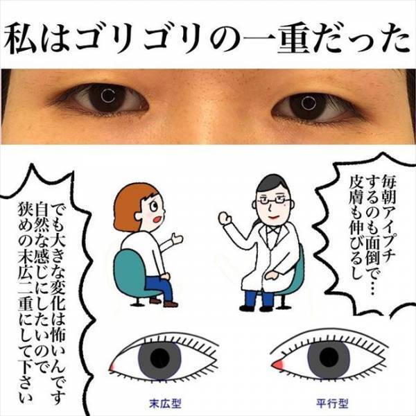 ＜喪女が二重整形＞「お願いします」まさかの予定変更！？整形前のカウンセリングで決断したことは