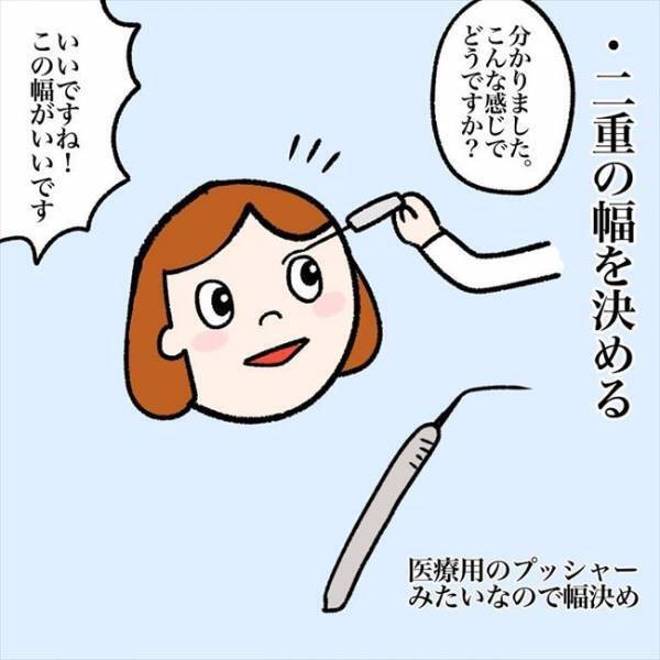 ＜喪女が二重整形＞「お願いします」まさかの予定変更！？整形前のカウンセリングで決断したことは