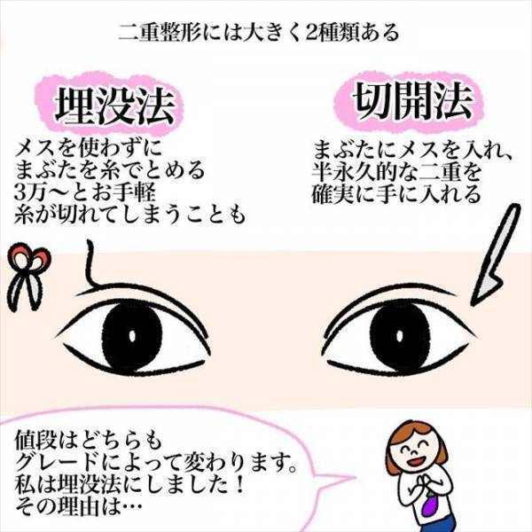 ＜喪女が二重整形＞「お願いします」まさかの予定変更！？整形前のカウンセリングで決断したことは