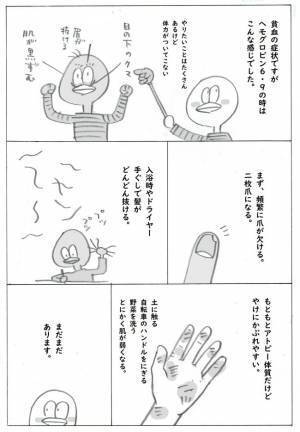 ＜筋腫が巨大化＞「ボリボリ…」貧血で嗜好が激変！？気づけば冷凍庫の大量のモノが