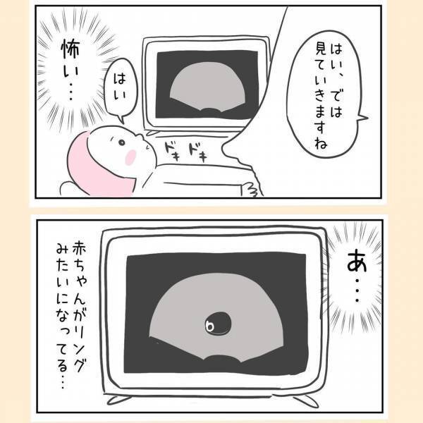 「怖い…」診察台に上がっていよいよ心拍確認。高齢妊娠の私は果たして！？＜44歳で妊娠＞