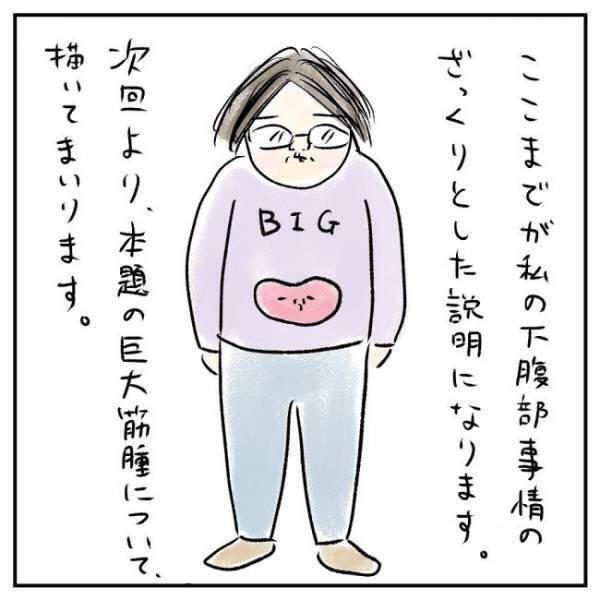 「珍しいです」まさかのレアケース！？さらに立て続けに＜巨大筋腫＞