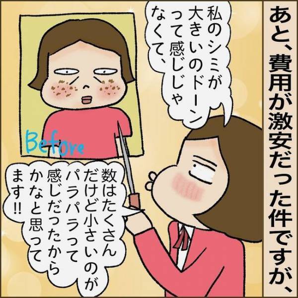 ＜51歳シミ取り初挑戦＞「まさか失敗？」シミ取り後、鏡を見て驚愕。赤黒い跡になっていて！？