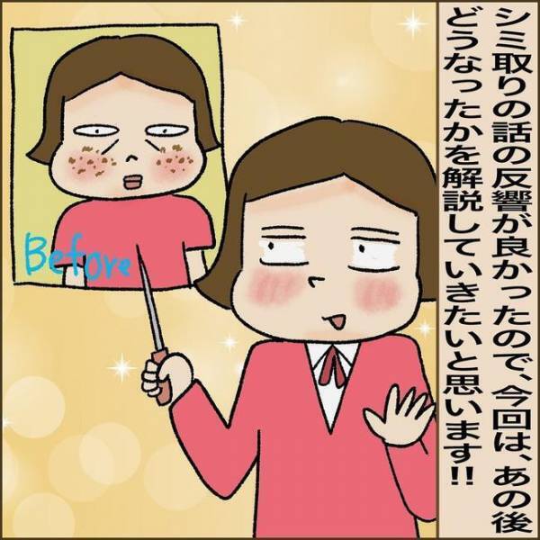 ＜51歳シミ取り初挑戦＞「まさか失敗？」シミ取り後、鏡を見て驚愕。赤黒い跡になっていて！？