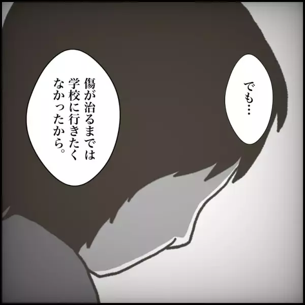 「傷が…」不登校だった生徒が学校へ。友だちに理由を尋ねられた少年の答えに違和感＜小学生トラブル＞