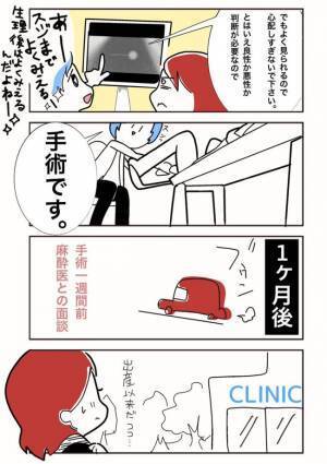 「スジまでよく見えるね〜」ギョッ！医師が放った衝撃の言葉とは？＜ポリープ取りました＞