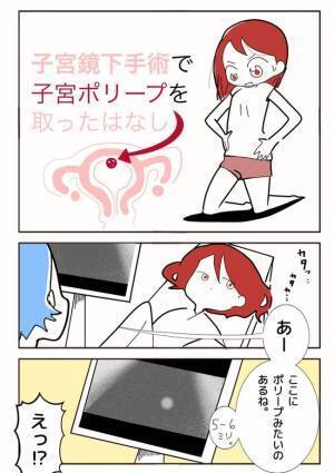 「スジまでよく見えるね〜」ギョッ！医師が放った衝撃の言葉とは？＜ポリープ取りました＞