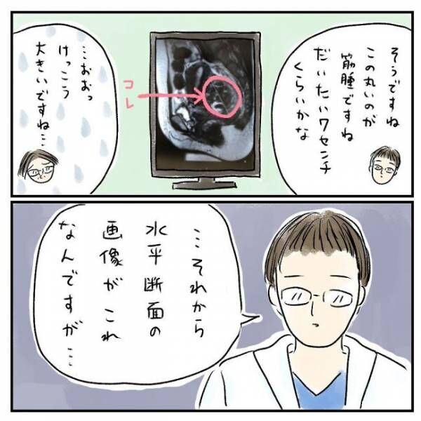 「全部筋腫です」えぇ！？MRI画像に映っていた物に衝撃 #巨大筋腫7