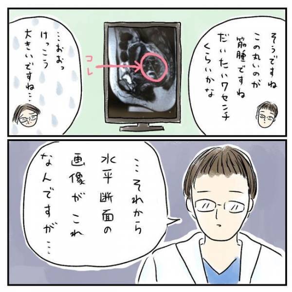 「全部筋腫です」えぇ！？MRI画像に映っていた物に衝撃＜巨大筋腫＞