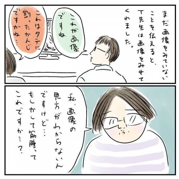 「全部筋腫です」えぇ！？MRI画像に映っていた物に衝撃＜巨大筋腫＞