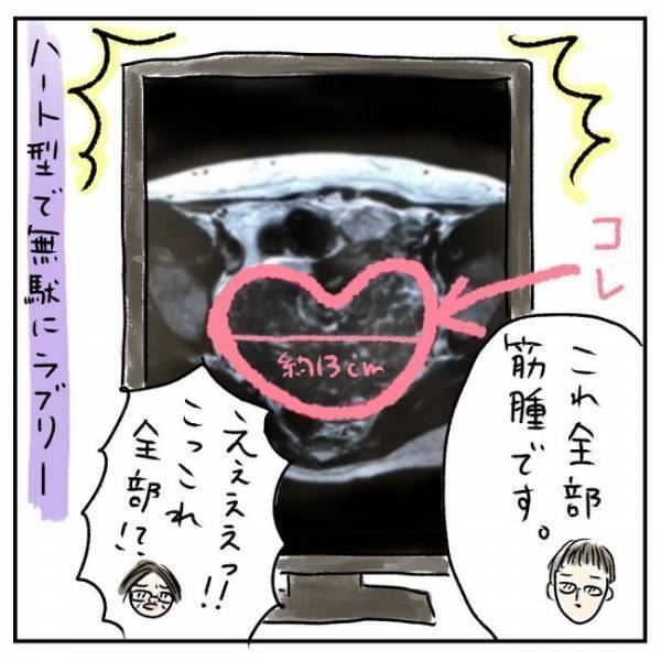 「全部筋腫です」えぇ！？MRI画像に映っていた物に衝撃＜巨大筋腫＞