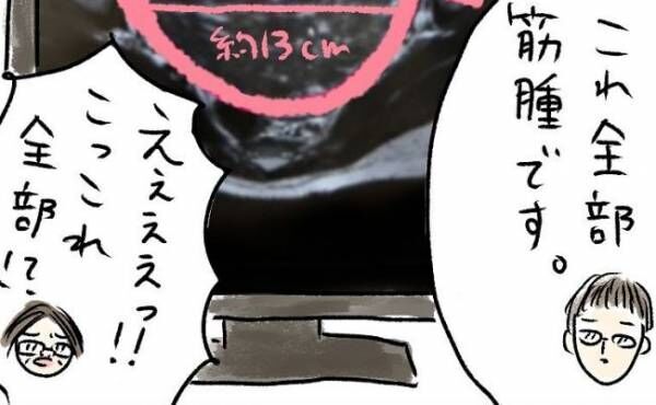 「全部筋腫です」えぇ！？MRI画像に映っていた物に衝撃＜巨大筋腫＞