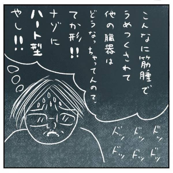 「臓器は大丈夫でしょうか？」医師に聞くと衝撃の答えが＜巨大筋腫＞