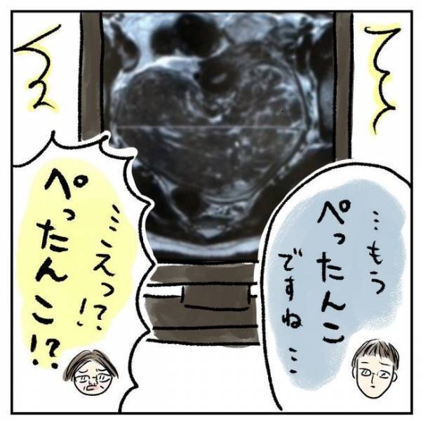 「臓器は大丈夫でしょうか？」医師に聞くと衝撃の答えが＜巨大筋腫＞