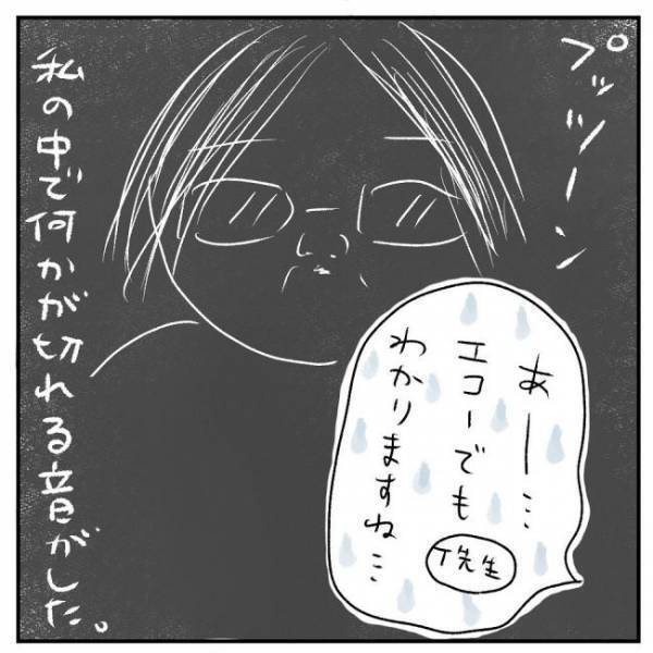 「エコーでも見えます」プッツーン…何かが切れる音がした瞬間＜巨大筋腫＞