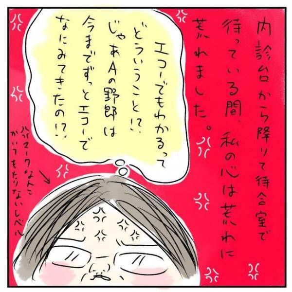 「エコーでも見えます」プッツーン…何かが切れる音がした瞬間＜巨大筋腫＞