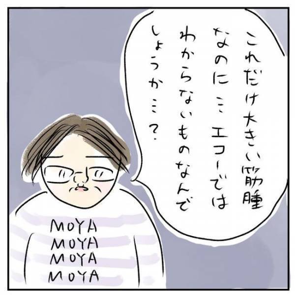 「エコーでも見えます」プッツーン…何かが切れる音がした瞬間＜巨大筋腫＞