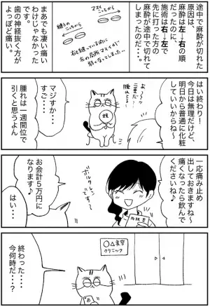 「5万で悩み解消！」面倒なアイプチからの卒業。埋没法で得たものは？＜埋没レポ 後編＞