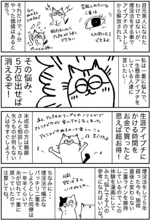 「5万で悩み解消！」面倒なアイプチからの卒業。埋没法で得たものは？＜埋没レポ 後編＞