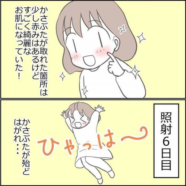 「本当に大丈夫？」顔面を見て夫がドン引き。シミ取り後の顔を心配されて！？＜ママがシミ取り＞