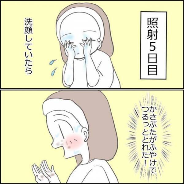 「本当に大丈夫？」顔面を見て夫がドン引き。シミ取り後の顔を心配されて！？＜ママがシミ取り＞