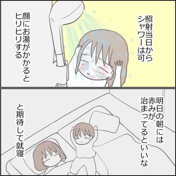 「本当に大丈夫？」顔面を見て夫がドン引き。シミ取り後の顔を心配されて！？＜ママがシミ取り＞