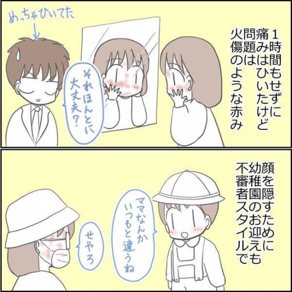 「本当に大丈夫？」顔面を見て夫がドン引き。シミ取り後の顔を心配されて！？＜ママがシミ取り＞