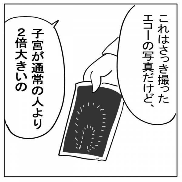 「あなたの子宮は他の人と比べて…」医師からの信じられない宣告とは？＜不妊の原因は？＞