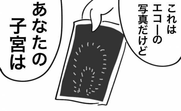 「あなたの子宮は他の人と比べて…」医師からの信じられない宣告とは？＜不妊の原因は？＞