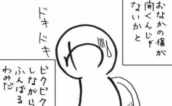 「おなかの傷が開いたらどうしよう」→トイレで踏ん張った結果！？＜7.5cmに腫れた卵巣＞