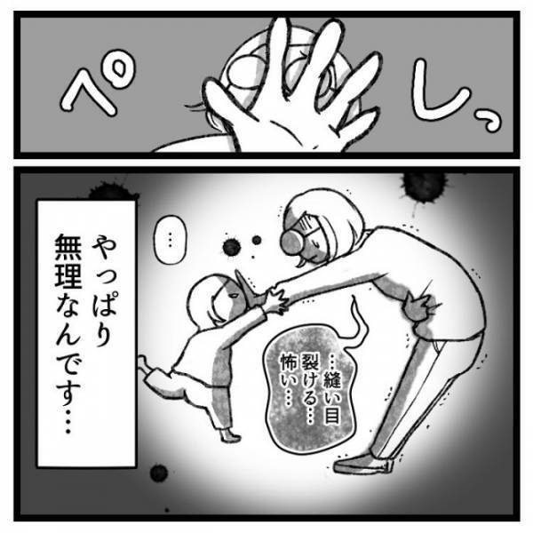 「ママ、手術したばかりだから」抱っこを断ると次女の反応は！？＜おなかの爆弾とりました＞