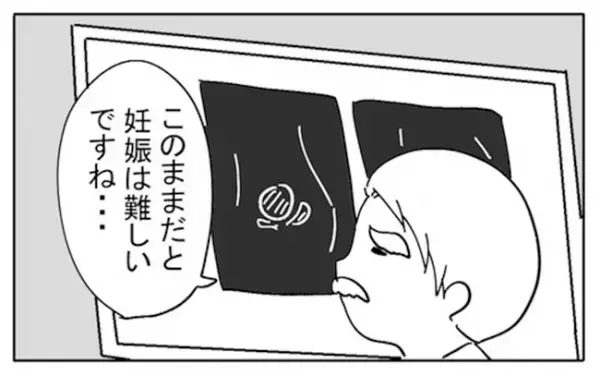 「巨大な筋腫のせいで…」MRI検査でわかった驚くべき事実とは？＜不妊の原因は？＞