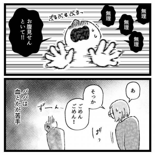 「ギャアアア！！」お風呂に入ろうとすると夫が大絶叫！？そのワケとは？＜おなかの爆弾とりました＞