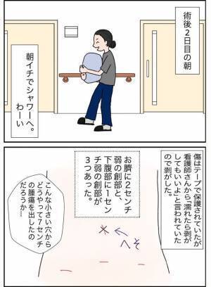 「気持ち悪っ」切除した腫瘍の見た目が衝撃的すぎて！ ＜7cmの卵巣＞