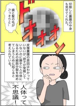 「気持ち悪っ」切除した腫瘍の見た目が衝撃的すぎて！ ＜7cmの卵巣＞