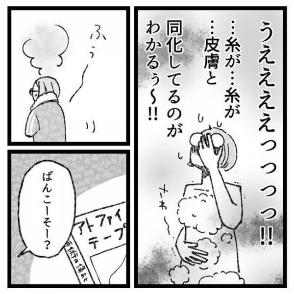 「ぶりゅっ」→ギャーッ！おなかの傷口から出てきたものとは！？＜おなかの爆弾とりました＞