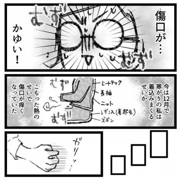 「ぶりゅっ」→ギャーッ！おなかの傷口から出てきたものとは！？＜おなかの爆弾とりました＞